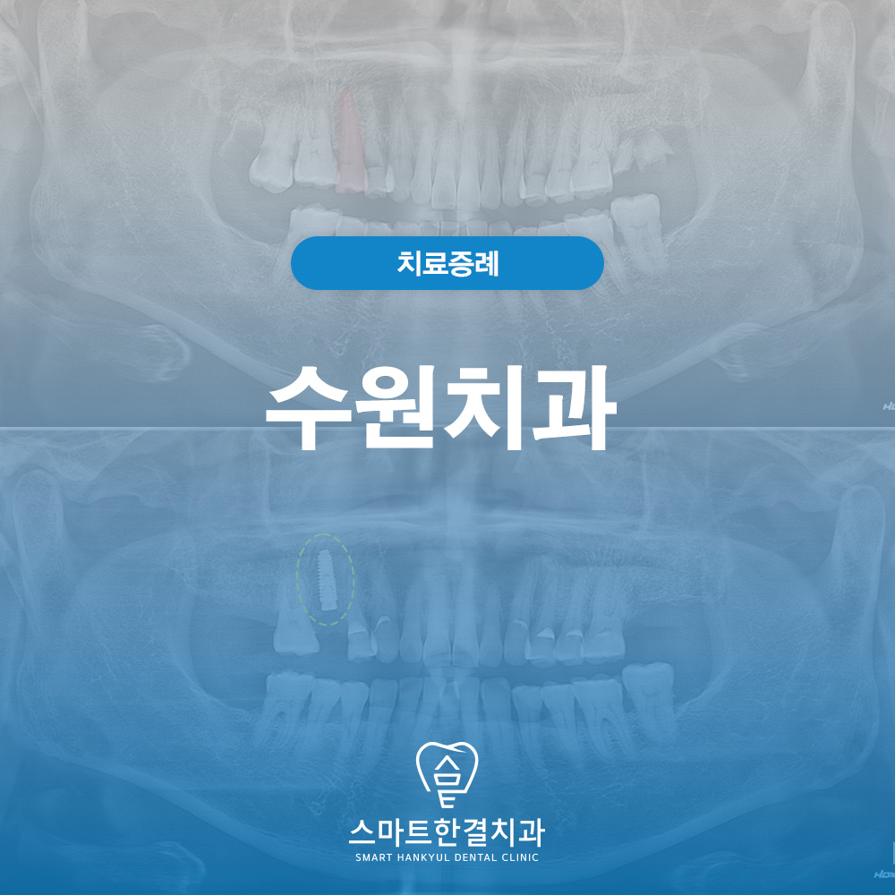 수원치과
