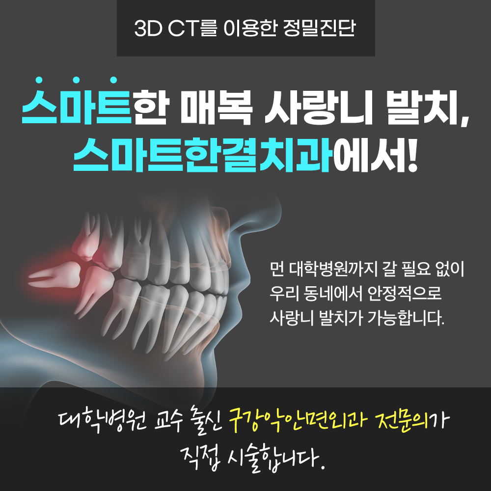 화서동사랑니