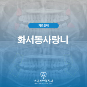 화서동사랑니