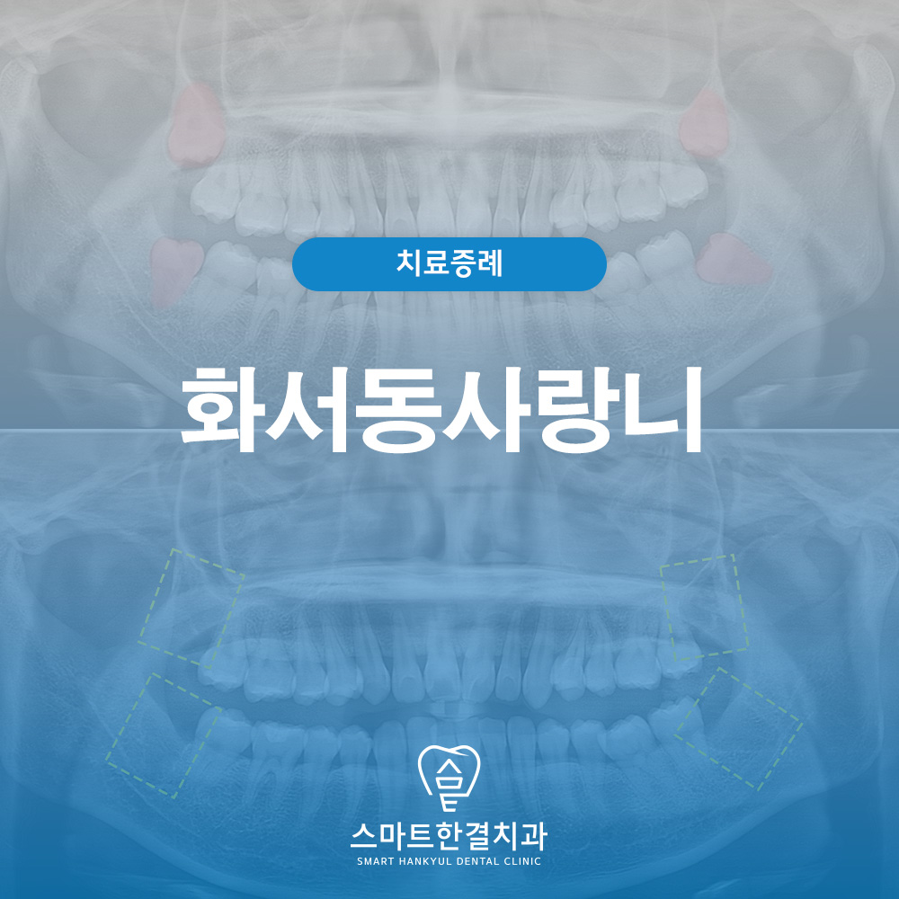 화서동사랑니