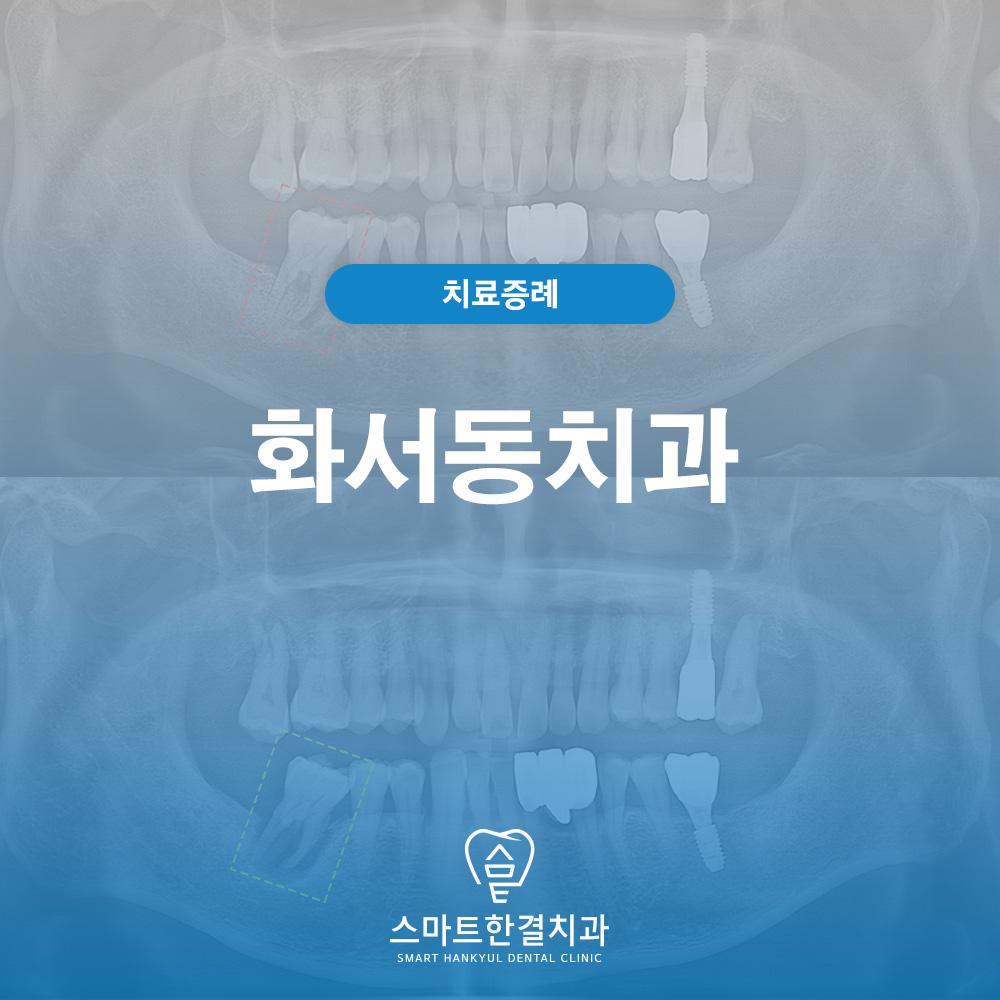 화서동치과
