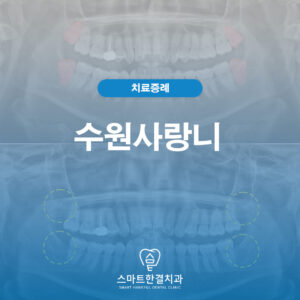 수원사랑니
