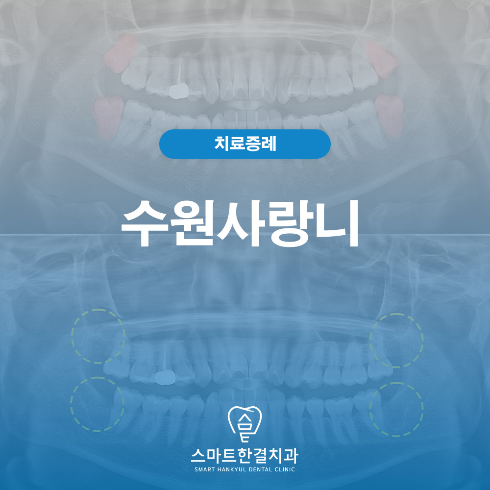 수원사랑니
