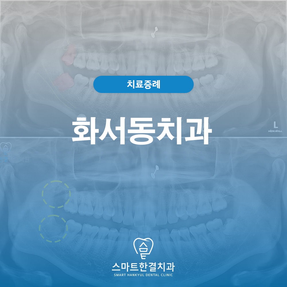 화서동치과