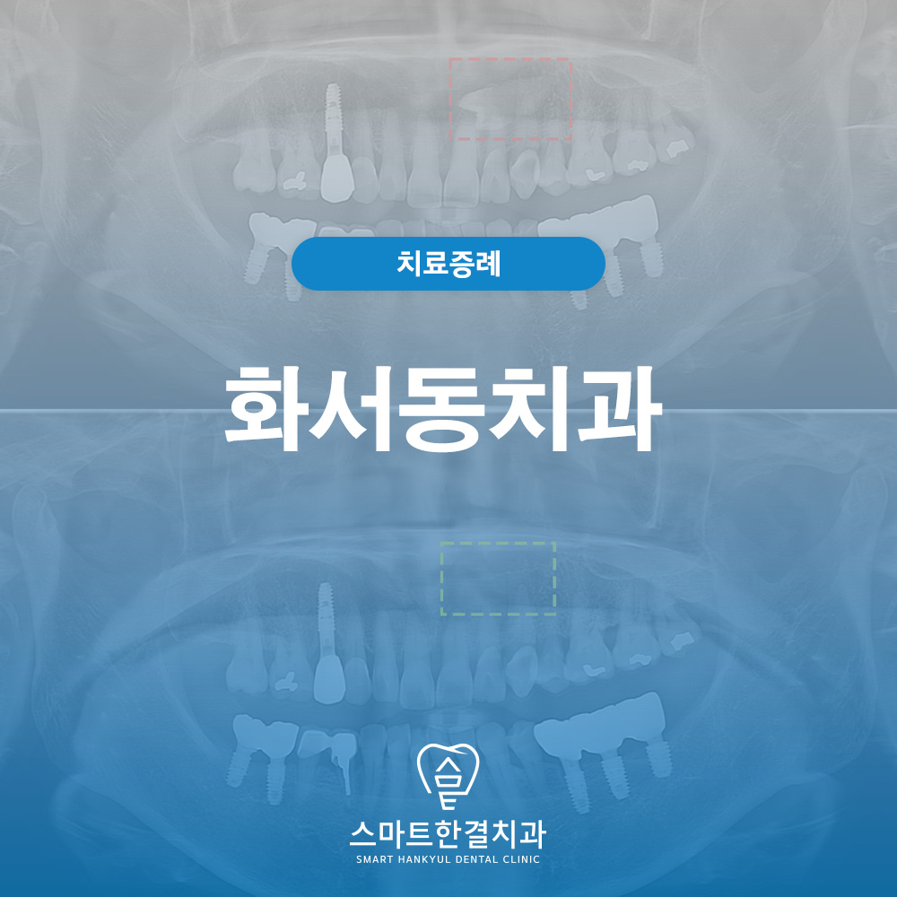 화서동치과