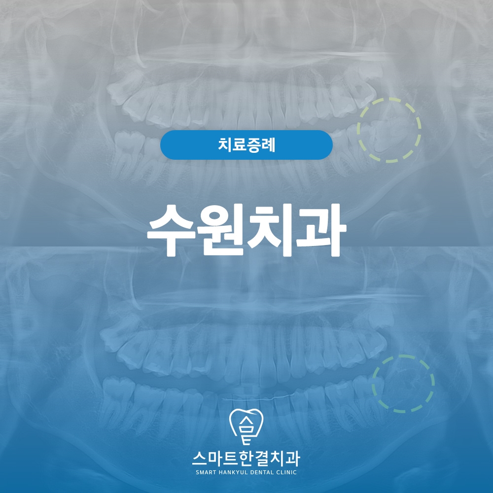 수원치과