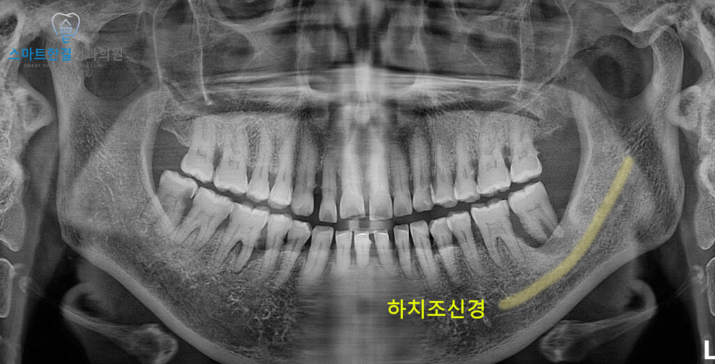 화서동치과