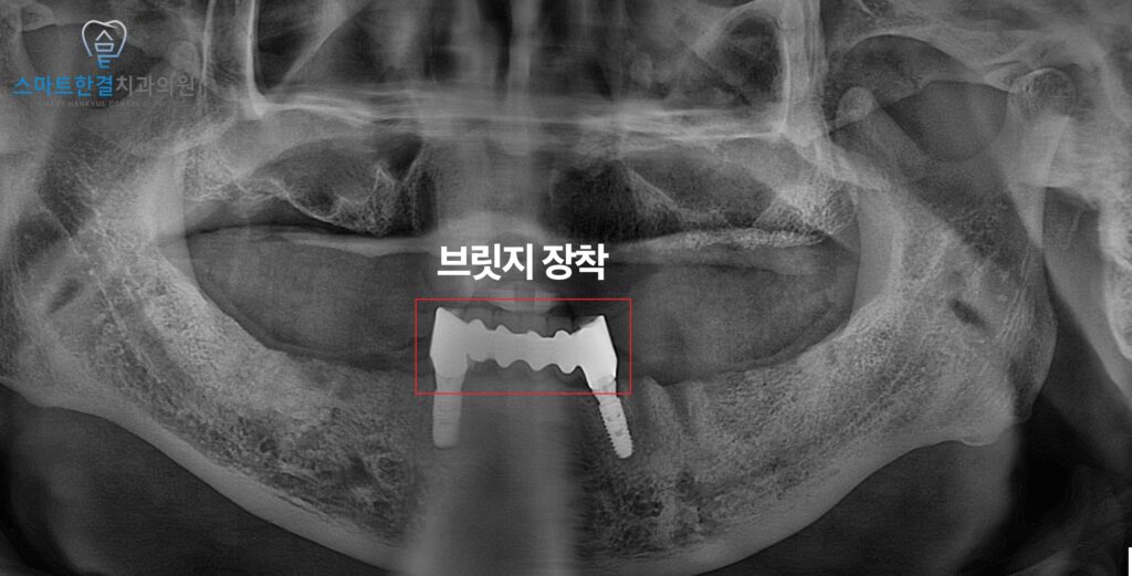 화서동치과