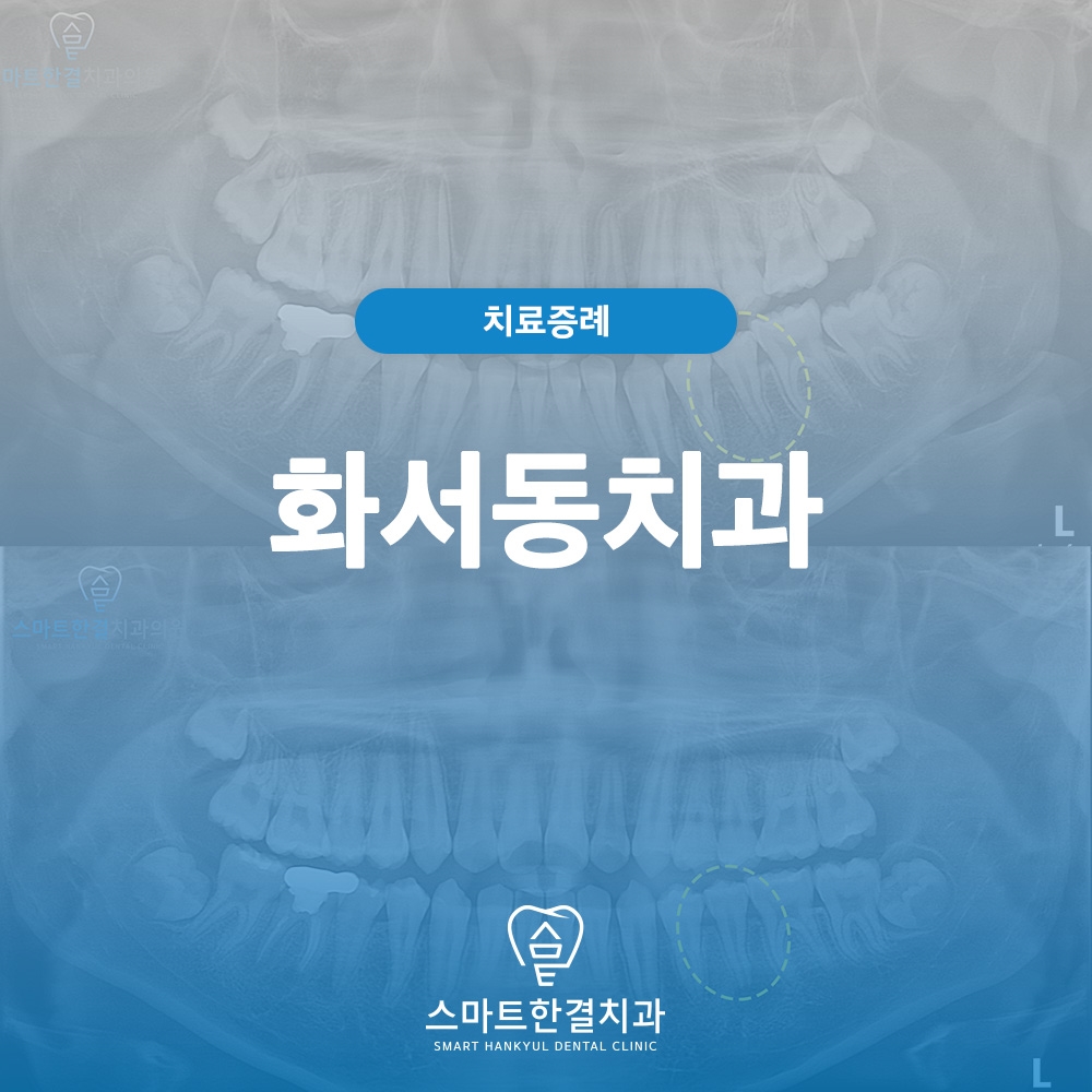 화서동치과