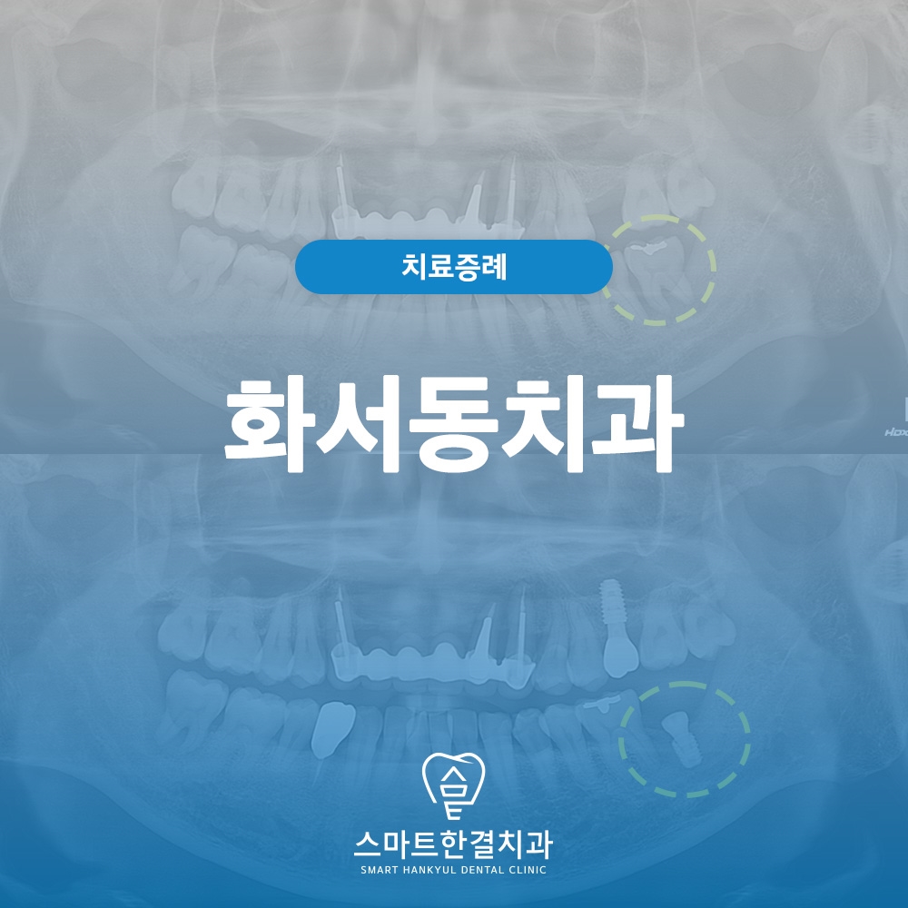 화서동치과