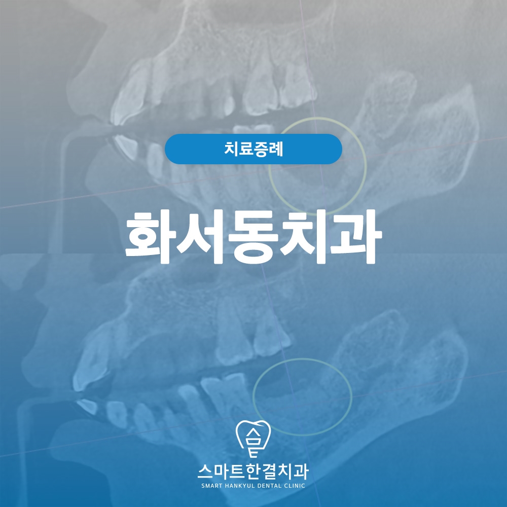 화서동치과