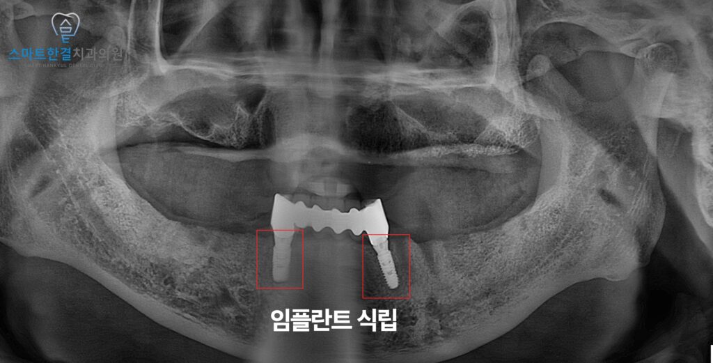 화서동치과