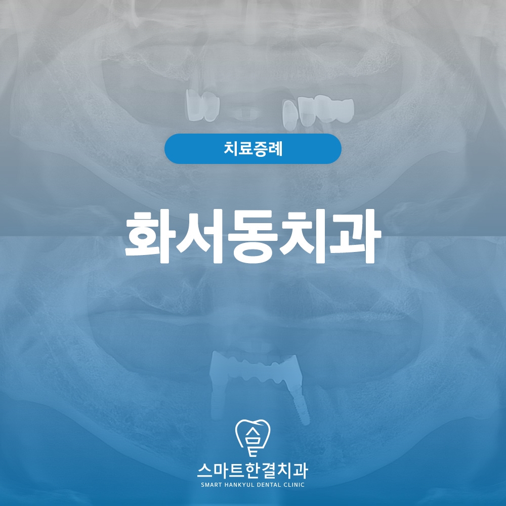 화서동치과