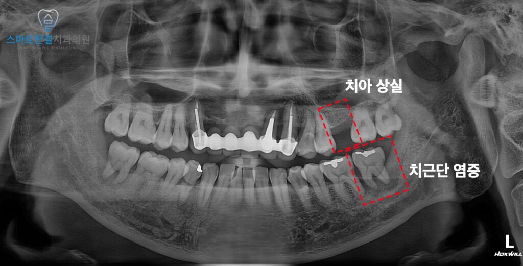 화서동치과