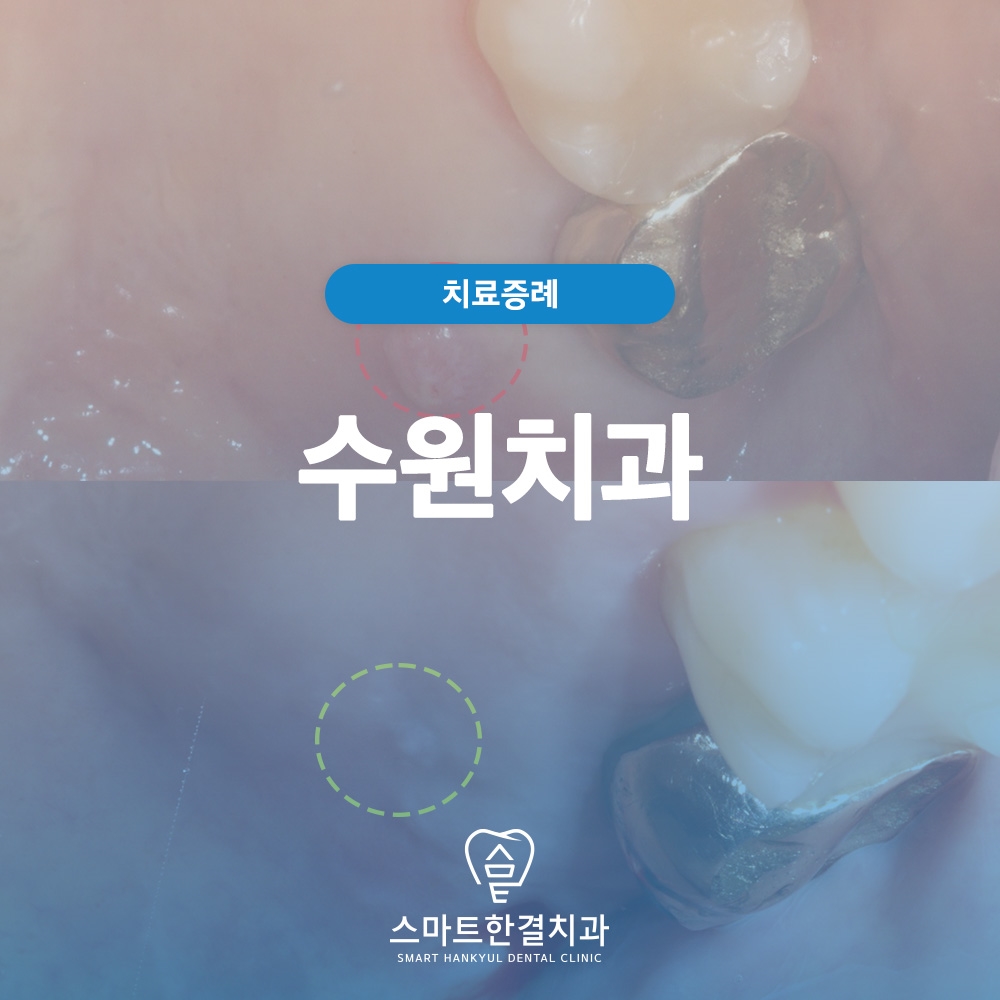 수원치과