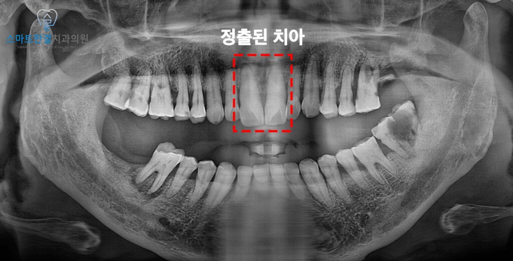 팔달구치과