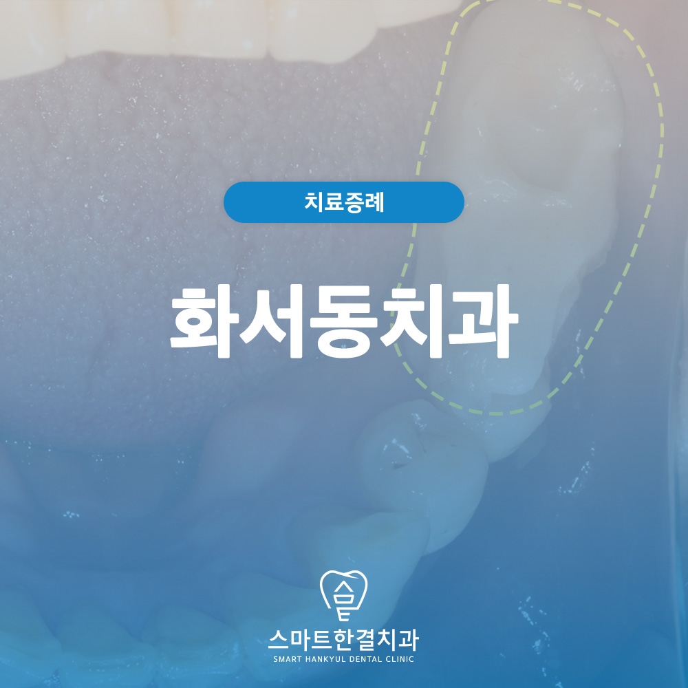 화서동치과
